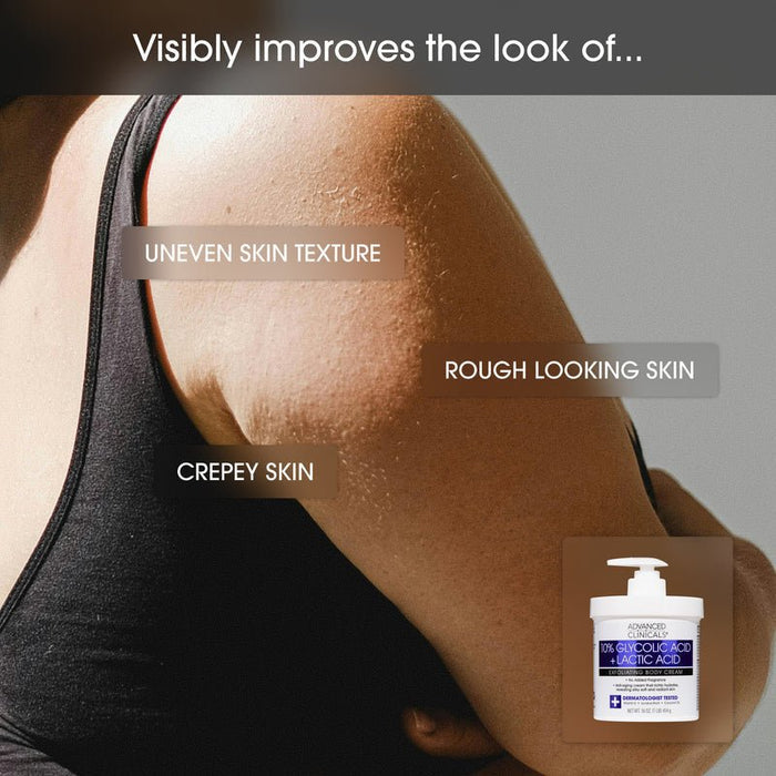 Advanced Clinicals 10% Glycolic Acid & Lactic Acid Exfoliating Body Cream 454g كريم الجسم المقشر من أدفانسد كلينيكالز، يحتوي على 10% من حمض الجليكوليك وحمض اللاكتيك - Princess Cosmetics Qatar