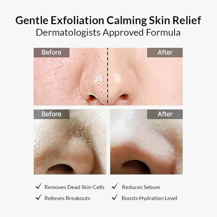 celimax Ji Woo Gae Heartleaf BHA Peeling Pad 125ml / 60pads – Skin Care | Korean Skincare Canada - VGLE Beauty