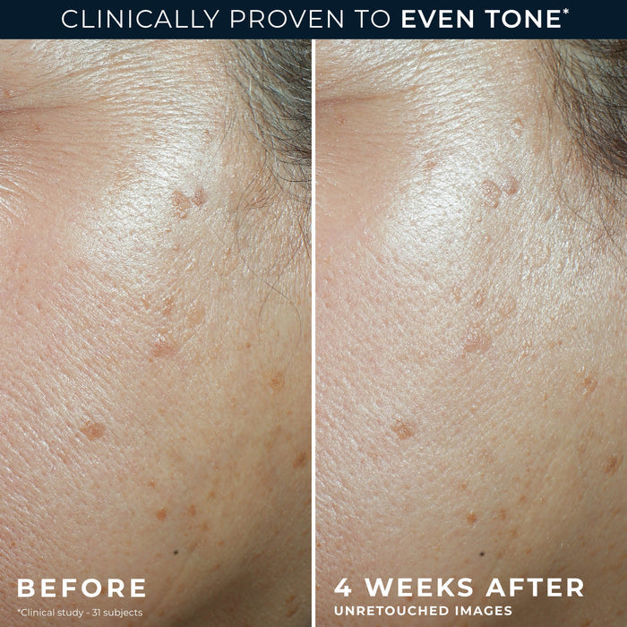 MULTI CORREXION® Even Tone + Lift Daily Moisturizer SPF 30 Before and after of participant's cheek showing visibly smoother skin tone