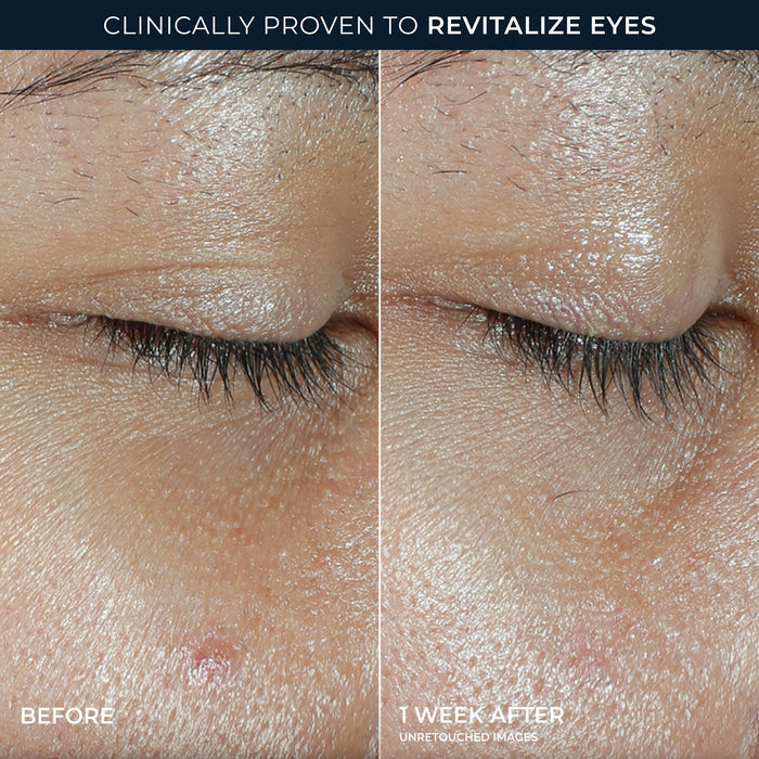 clinically proven to revitalize eyes