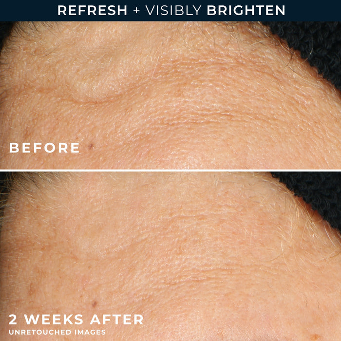 MULTI CORREXION® Revive + Glow Gel Cleanser before and after image showing customer eye and forehead area brighter and smoother after 2 weeks of use