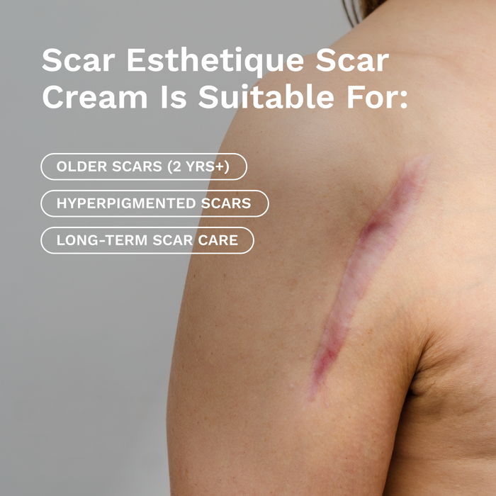 Scar Esthetique Scar Cream product image 2